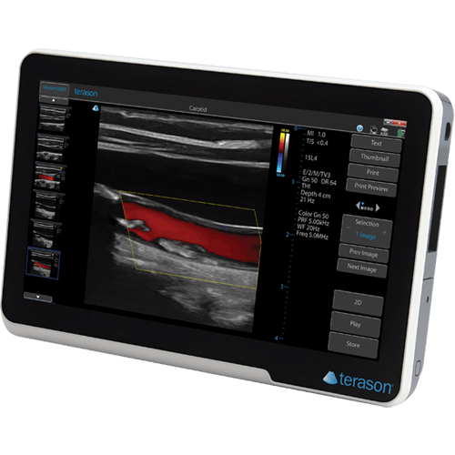 Terason uSmart 3200T PLUS